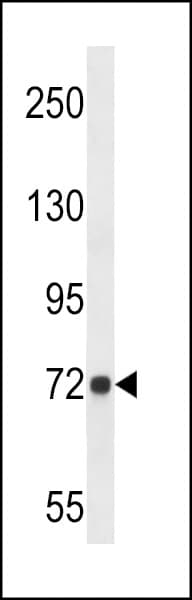 Polyclonal Rabbit anti-Human DPY19L4 Antibody (aa1-30, IHC, WB)