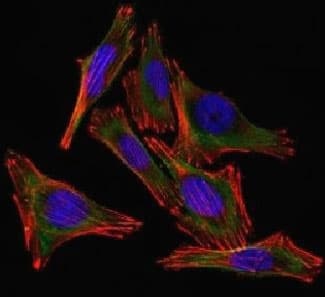 S100B / S100 Beta Antibody (clone 4C4.9)