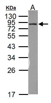 NDUFS1 Antibody (aa432-664)