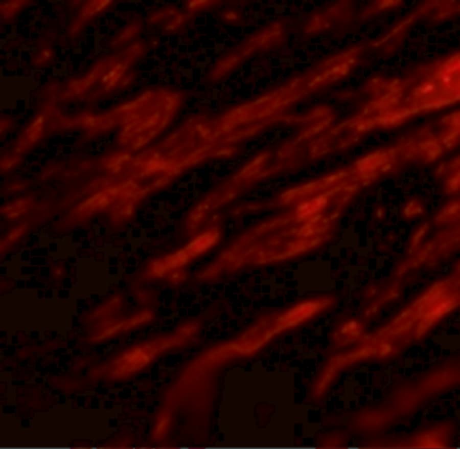 CD274 / B7-H1 / PD-L1 Antibody