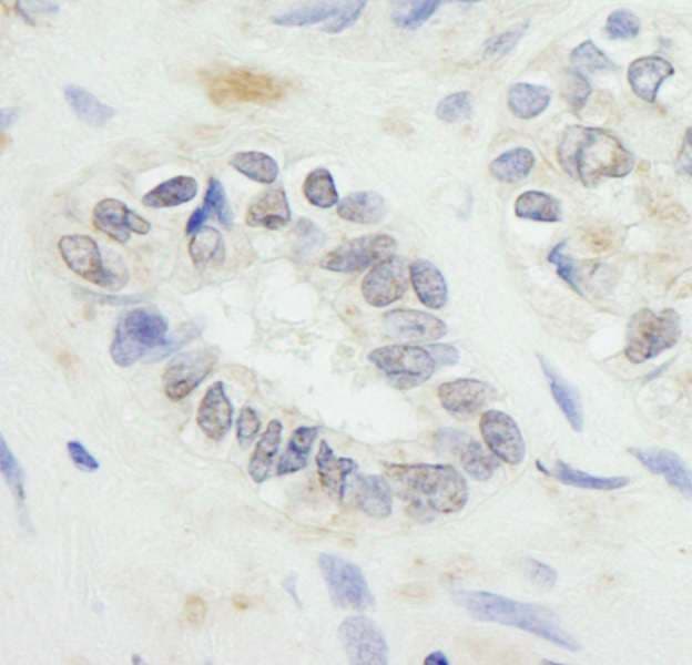 RNF20 Antibody (aa125-175)
