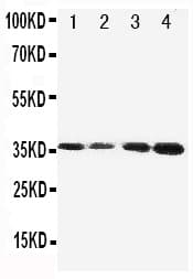 Polyclonal Rabbit anti-Human PROC / Protein C Antibody (aa446-461, IHC, WB)