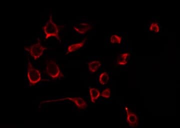 PLAGL1 / ZAC Antibody