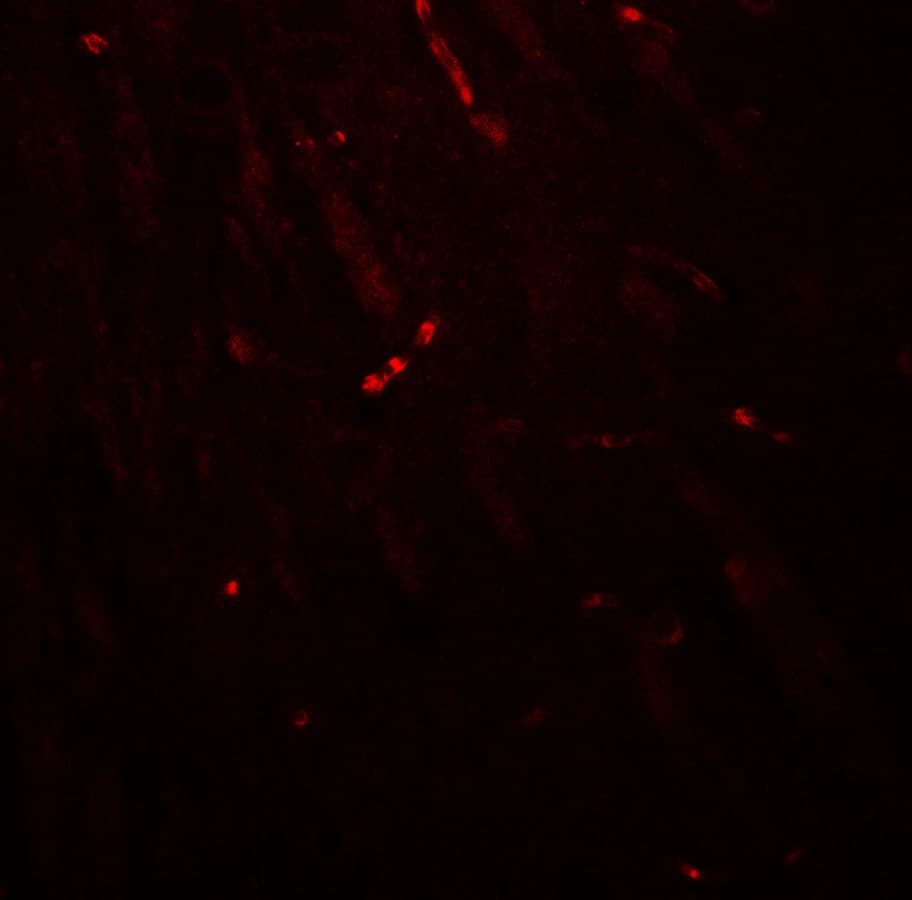 IHC-plus™ Polyclonal Rabbit anti-Human TWIK1 / KCNK1 Antibody (IHC, IF, WB)