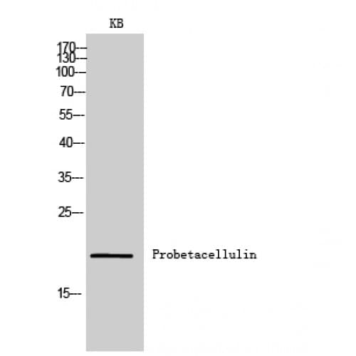 BTC / Betacellulin Antibody (21-70 aa, Internal)