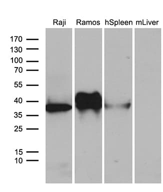 CD79B / CD79 Beta Antibody (clone OTI9H8)