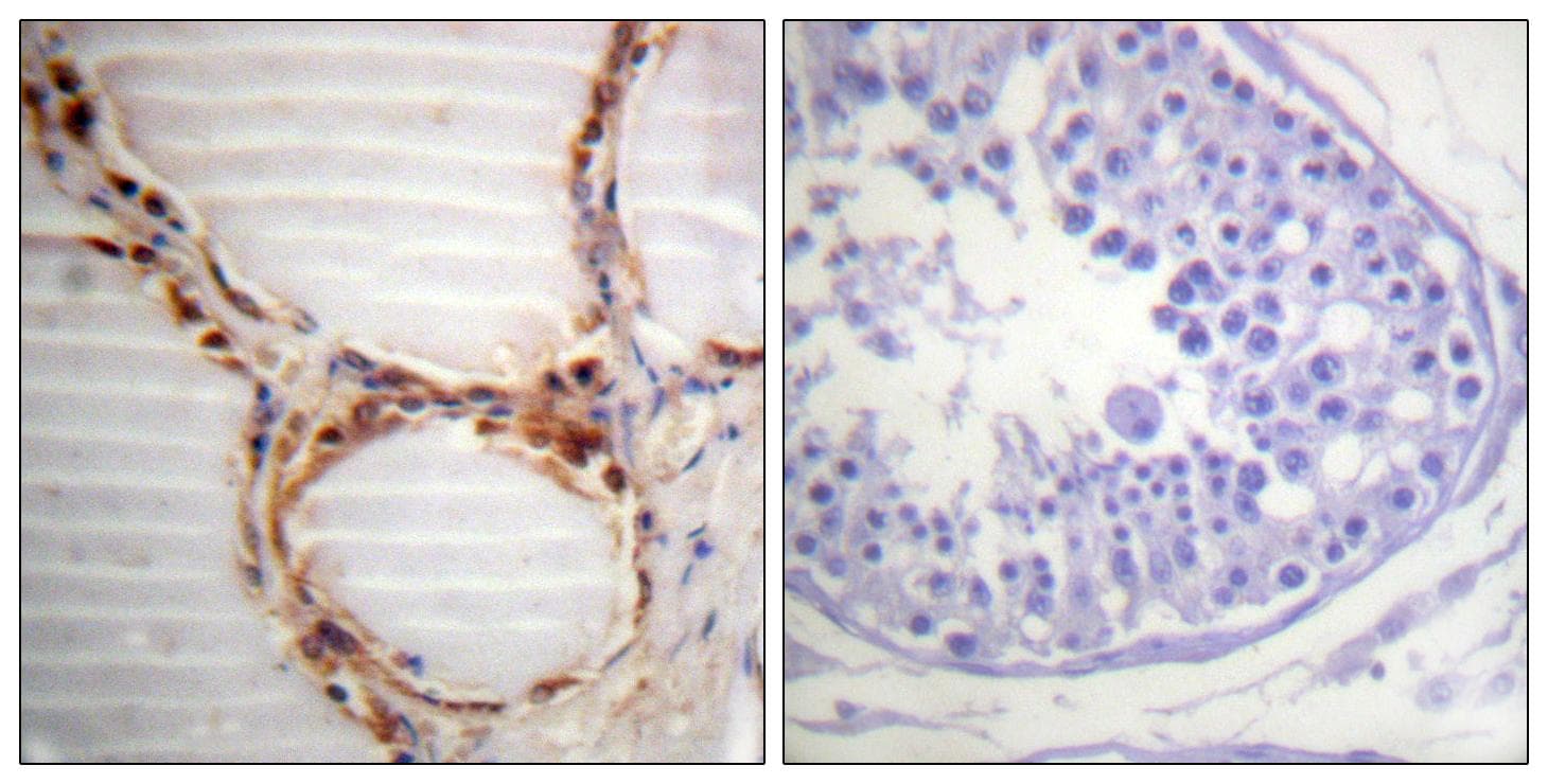 MCM4 Antibody (p54)
