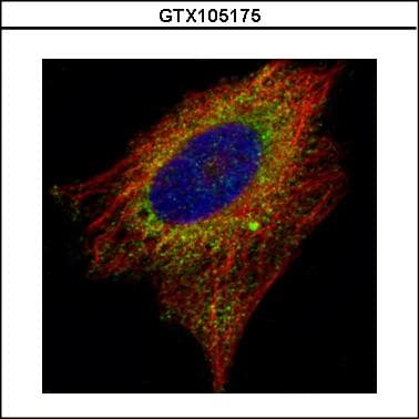 AIMP1 / EMAP II Antibody (aa1-263)