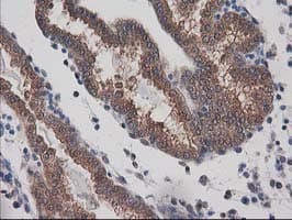 DSTN / Destrin Antibody (clone OTI1D5)