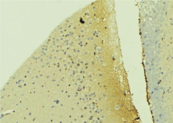PDPN / Podoplanin Antibody