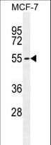 PMPCA Antibody (aa454-483)