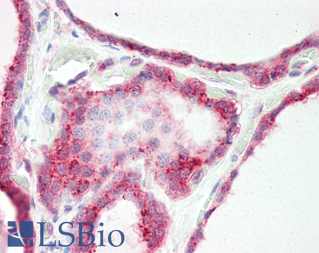 IHC-plus™ SLITRK4 Antibody