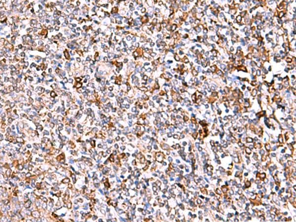 Polyclonal Rabbit anti-Human IP6K1 Antibody (IHC, WB)