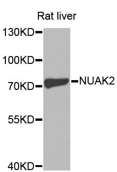 SNARK / NUAK2 Antibody