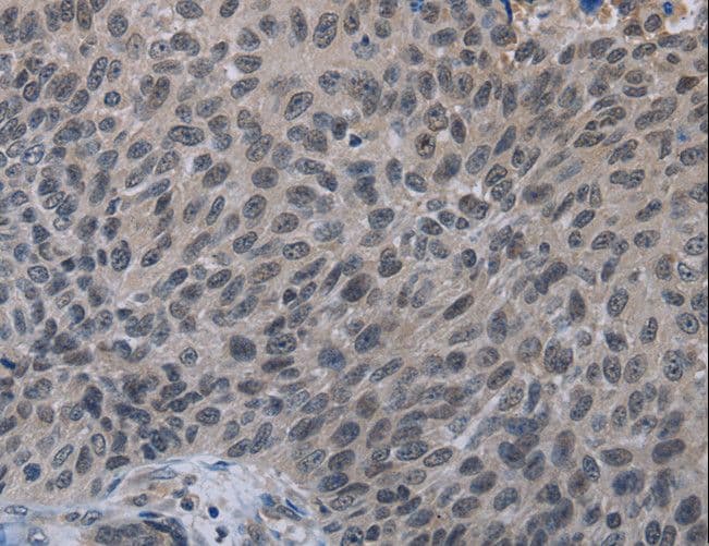 TP53AIP1 / p53 AIP1 Antibody