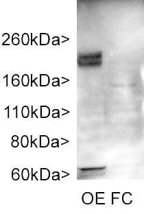 ADCY3 / Adenylate Cyclase 3 Antibody (aa1125-1144)