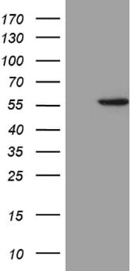 ALDH3B1 Antibody (aa1-465, clone OTI2F6, Carrier-free)