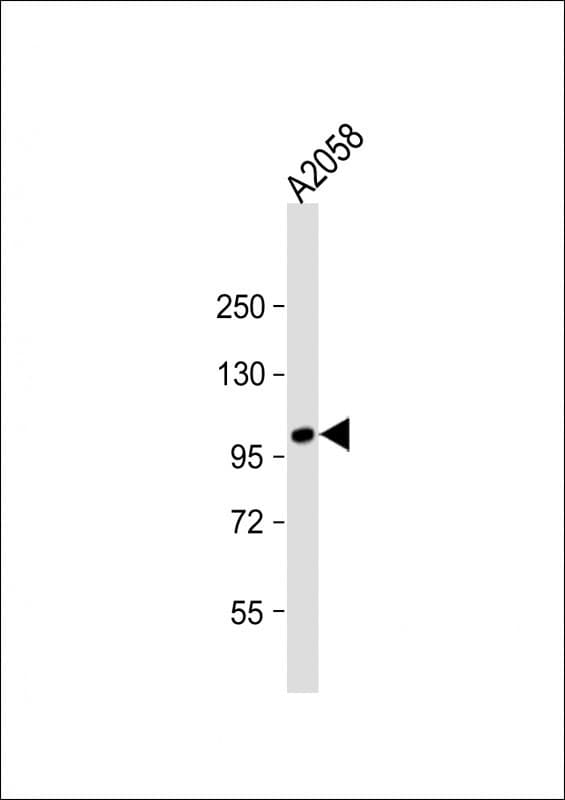 Polyclonal Rabbit anti-Human ADAMTS17 Antibody (N-Terminus, WB)