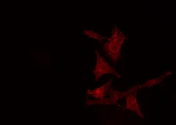 Polyclonal Rabbit anti-Human PPP2R5D Antibody (IF, WB)