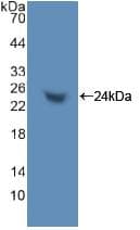 TNPO1 / Transportin 1 Antibody (aa626-836)