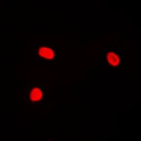 JUN / c-Jun Antibody (phospho-Thr239)
