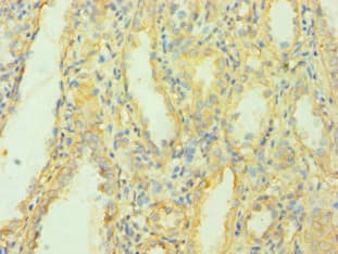 Polyclonal Rabbit anti-Human MCPH1 Antibody (aa536-835, IHC, WB)
