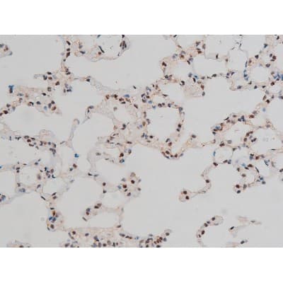 GATA1 Antibody (phospho-Ser142)