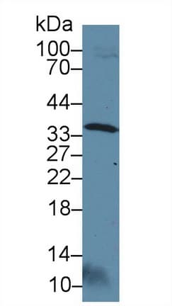 OTUB1 / OTU1 Antibody (aa1-271, APC)