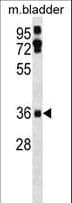 PIG8 / EI24 Antibody (aa263-290)