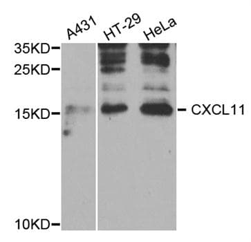 Polyclonal Rabbit anti-Human CXCL11 Antibody (IHC, WB)