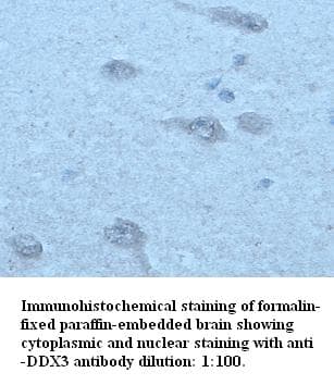 SCH9 Antibody (N-Terminus)