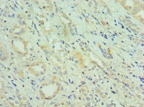 CETN2 / Centrin 2 Antibody (aa1-172)