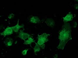 MGRN1 Antibody (clone OTI3A1)