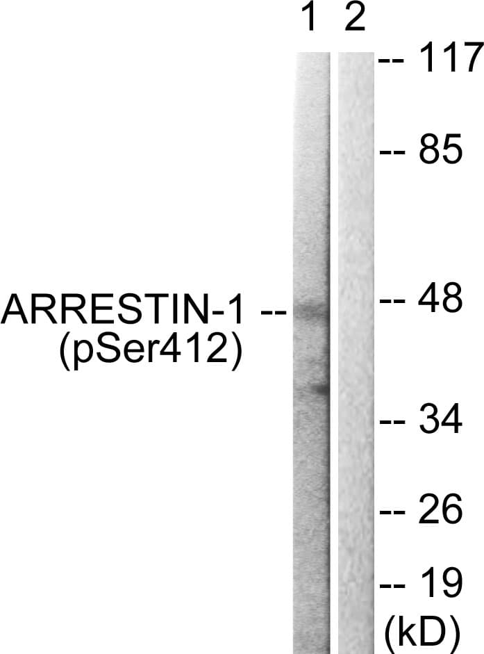ARRB1 / Beta Arrestin 1 Antibody (phospho-Ser412)
