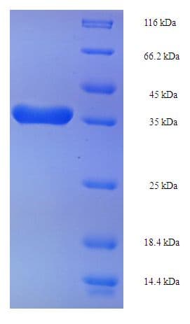 Arabidopsis thaliana FACT Complex Subunit SPT16 Protein (Recombinant His-SUMO)