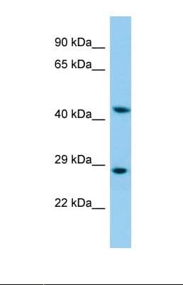 KRT35 / Keratin 35 / KRTHA5 Antibody (aa313-362)