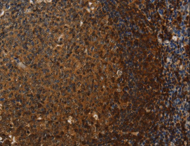 CLDN8 / Claudin 8 Antibody