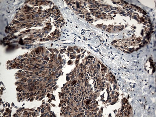 CTSL / Cathepsin L Antibody (aa114-333, clone OTI5A5)