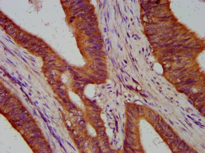 Polyclonal Rabbit anti-Human TIMELESS Antibody (IHC)