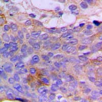 Polyclonal Rabbit anti-Human CSGALNACT1 Antibody (Internal, IHC, WB)