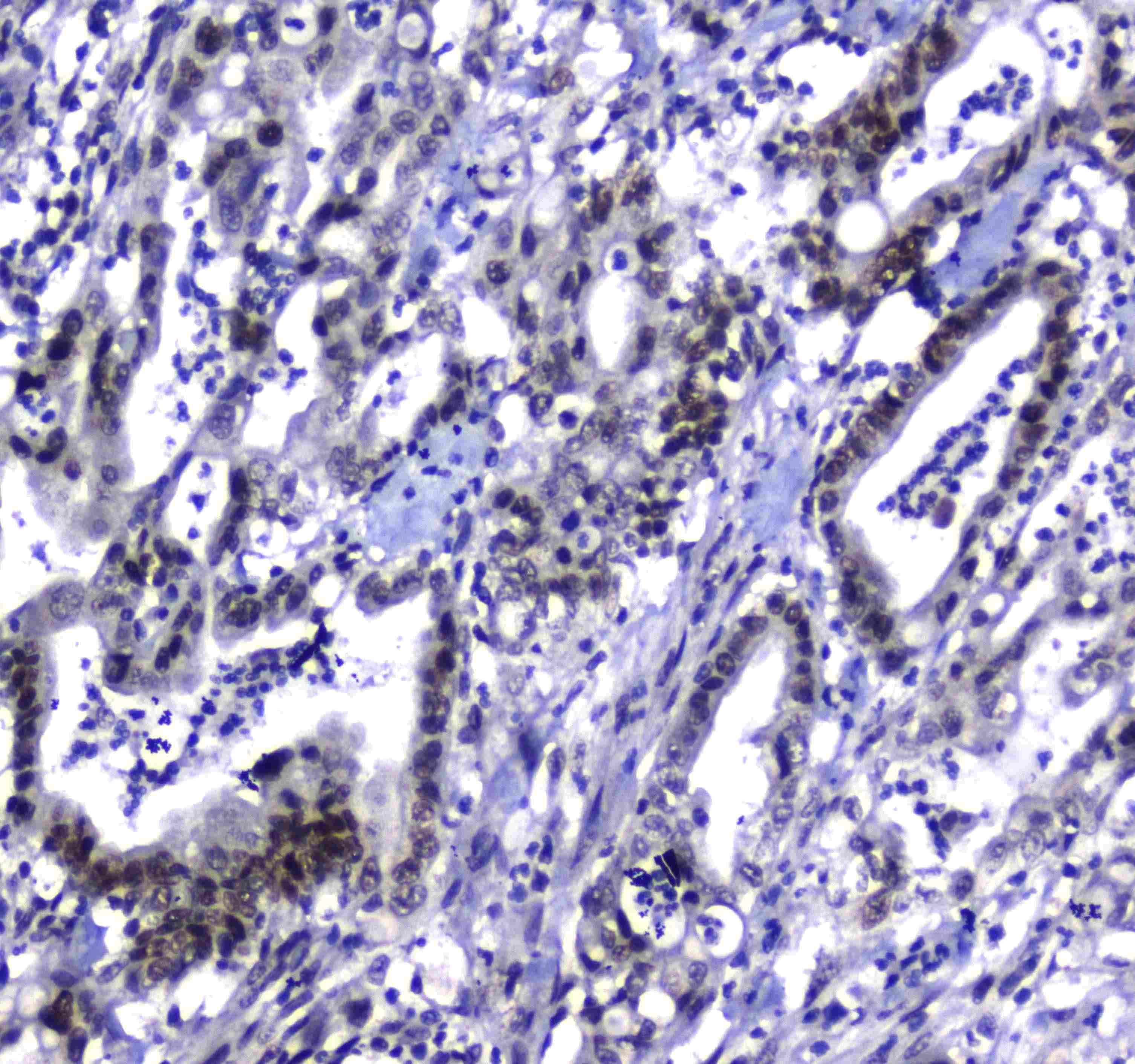MDC1 Antibody