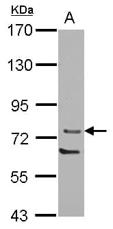 PRKCQ / PKC-Theta Antibody