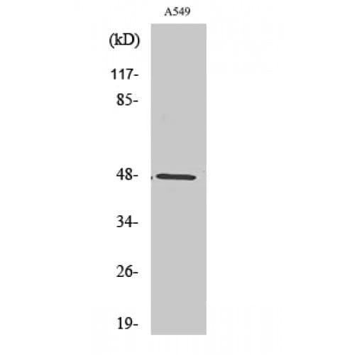 Polyclonal Rabbit anti-Human PSKH1 Antibody (230-310 aa, Internal, IHC, WB)