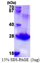 Human RAB3B Protein (Recombinant His)