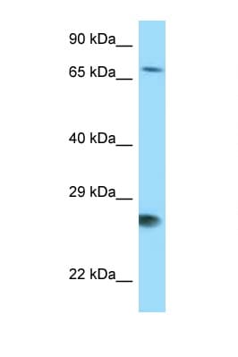 Polyclonal Rabbit anti-Human BAG1 / BAG-1 Antibody (aa75-124, WB)