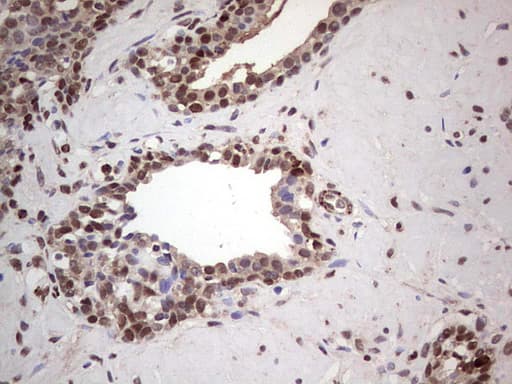 PCNA Antibody (clone OTI13G4)