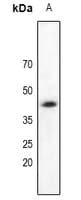 DAPK2 / DAP Kinase 2 Antibody