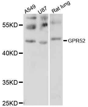 GPR52 Antibody