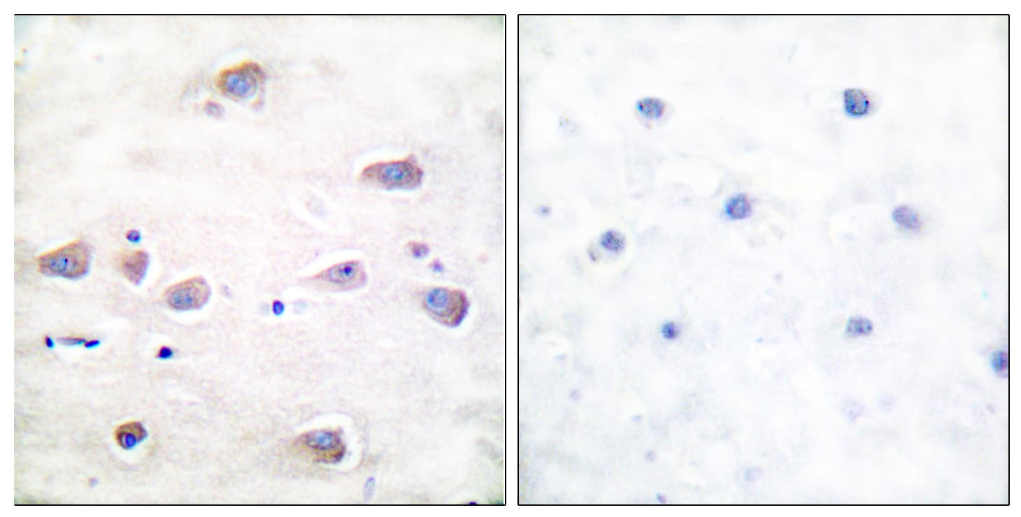 GRIN1 / NMDAR1 Antibody (phospho-Ser897)