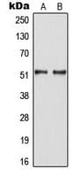Polyclonal Rabbit anti-Human HNF4A / HNF4 Antibody (phospho-Ser313, IHC, IF, WB)